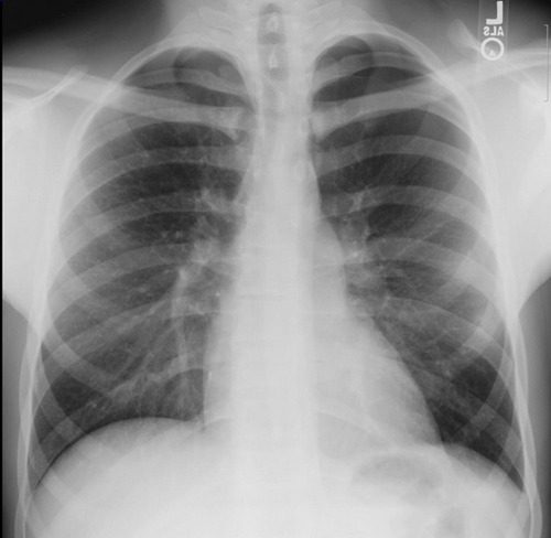 chest x-ray | The Trauma Pro